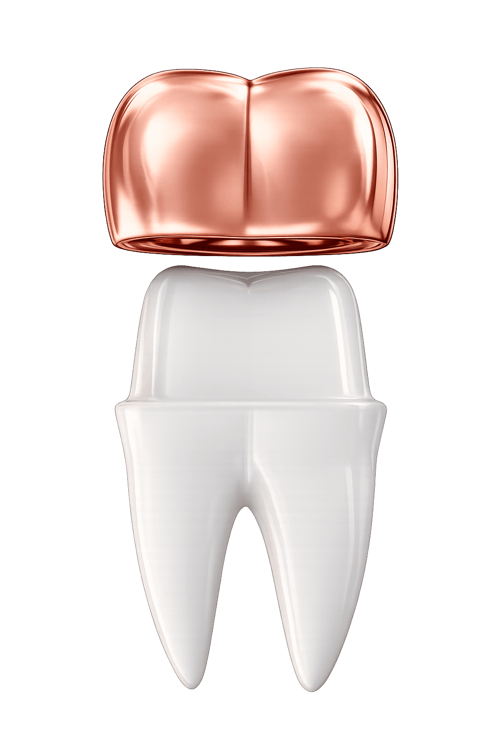 Crowns & Bridges Treatment